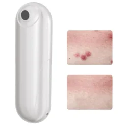 Bugbett Klåda Relief Tool USB Uppladdningsbart myggbettssug Kemikaliefritt för insektsbett Bigetingstick